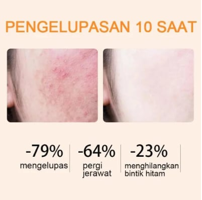 ✅ Official Store丨“BBOJI™ Orange Enzyme Exfoliating Gel