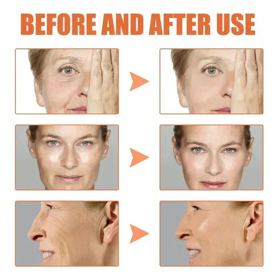 šLast Day Promotionš-BBOJIā¢Clostridium botulinum Face Serum