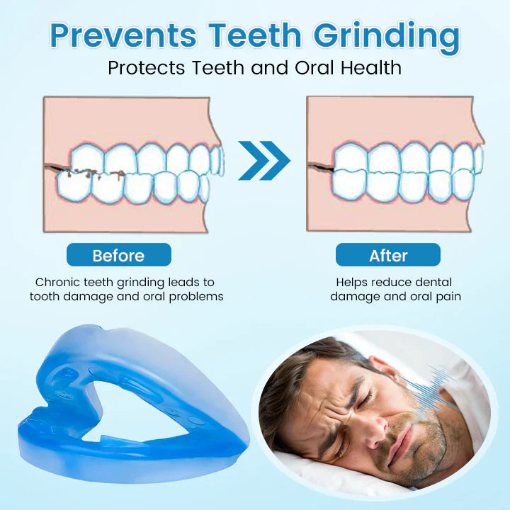 ✨QIAWI ™ SnoreRelief – FDA-Approved Anti-Snoring Mouthpiece🔥