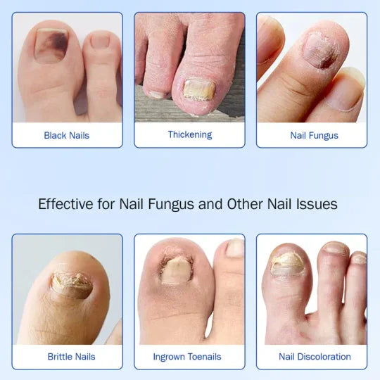 đ„đ„đ„Fungal Nail Patches, 21pcs/box Nail Health Care Patches, Nail Fungus Care Patches, Suitable for Solving Fungal Nails and Other Nail Problems, Nail Supplies, Daily Care Nails Kit Set
