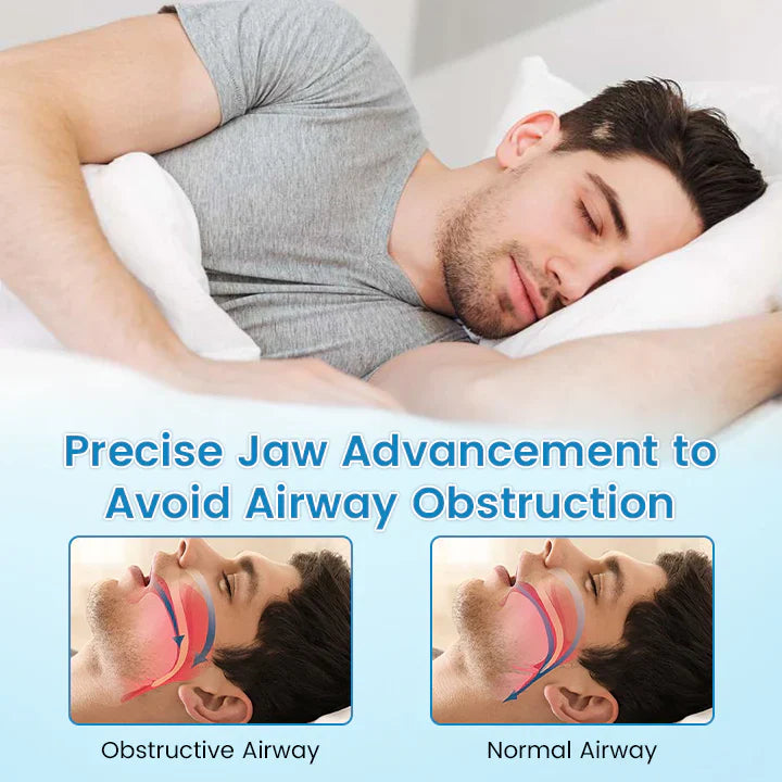 ✨QIAWI ™ SnoreRelief – FDA-Approved Anti-Snoring Mouthpiece🔥