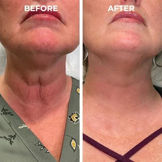 šLast Day Promotionš-BBOJIā¢Clostridium botulinum Face Serum