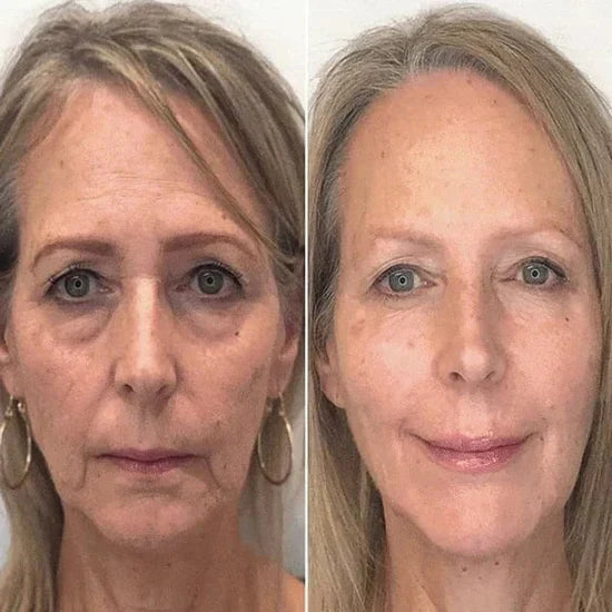 šLast Day Promotionš-BBOJIā¢Clostridium botulinum Face Serum