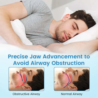 ✨QIAWI ™ SnoreRelief – FDA-Approved Anti-Snoring Mouthpiece🔥